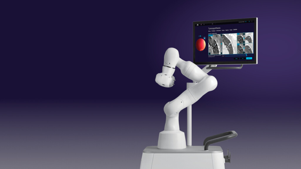 Wide shot of Noah Medical's Galaxy robotic arm and screen